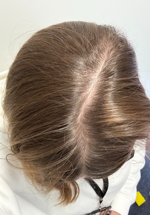 After