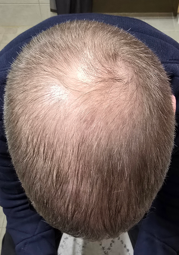 Before