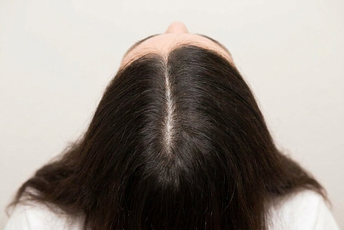 Part Line Density — Women — after