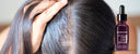 Sensitive and Dry Scalp, Symptoms of Sensitive Scalp