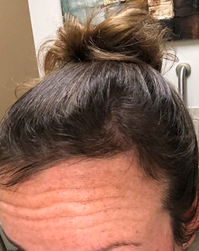 3 MONTHS