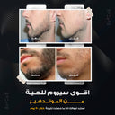 Beard Growth Serum — Classic