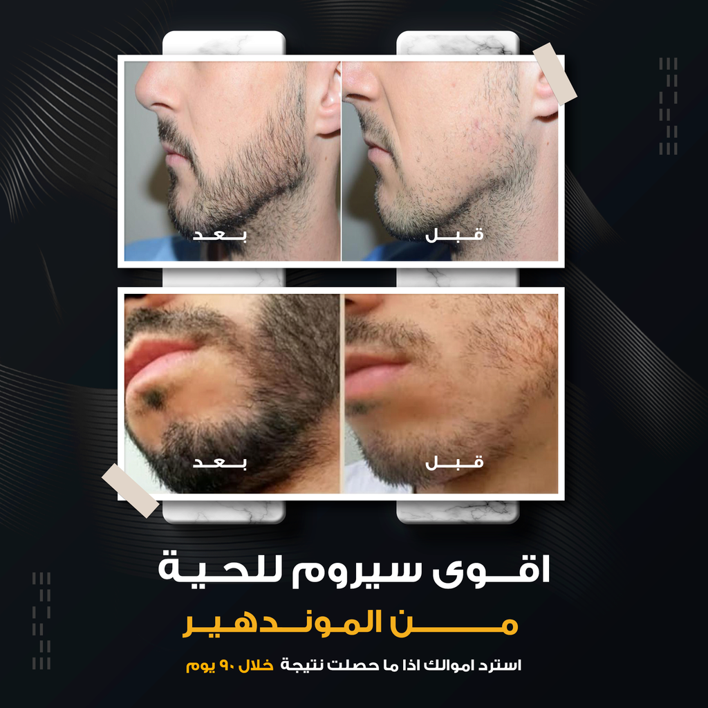 Beard Growth Serum – Herbal Energy Complex