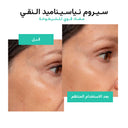 The Almond Beauty ClearSkin Zinc 5% Serum