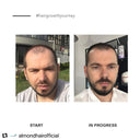 Essential Men’s Hair Growth set
