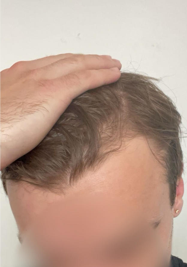 3 MONTHS