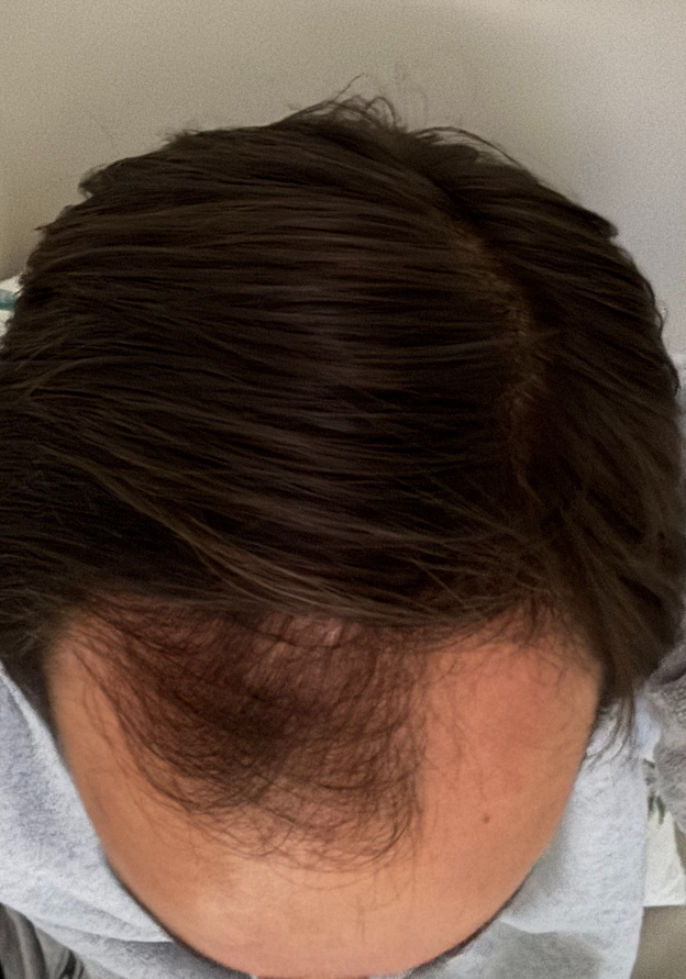 After