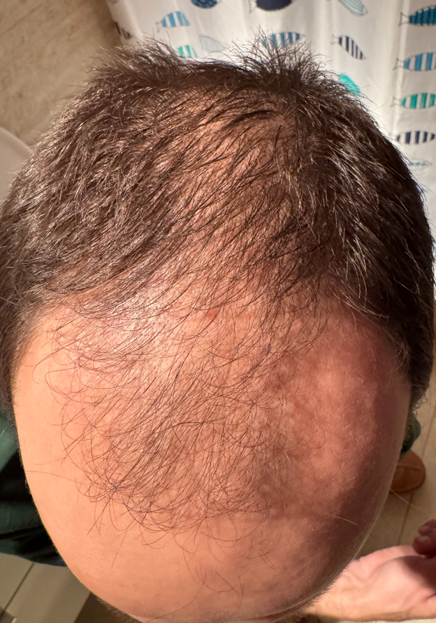 Before