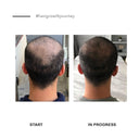 Essential Men’s Hair Growth set