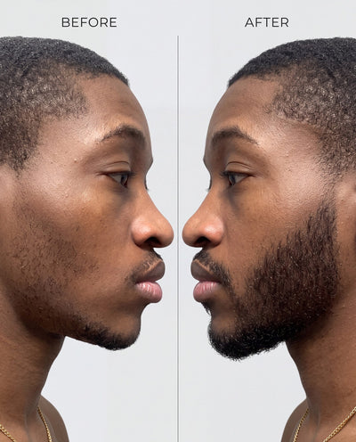 AvenaPlex™ Beard Serum