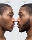 Advanced Beard Growth & Care Set