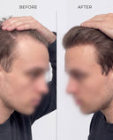 RootBioTec™ Hair Serum for Men