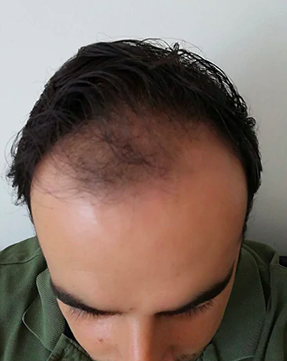 Before