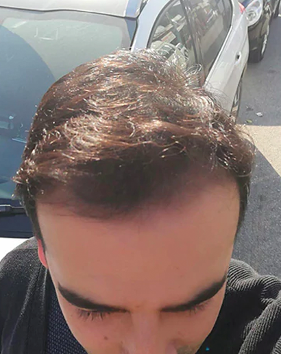 5 MONTHS