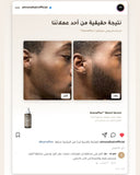 AvenaPlex™ — real customer result, before and after