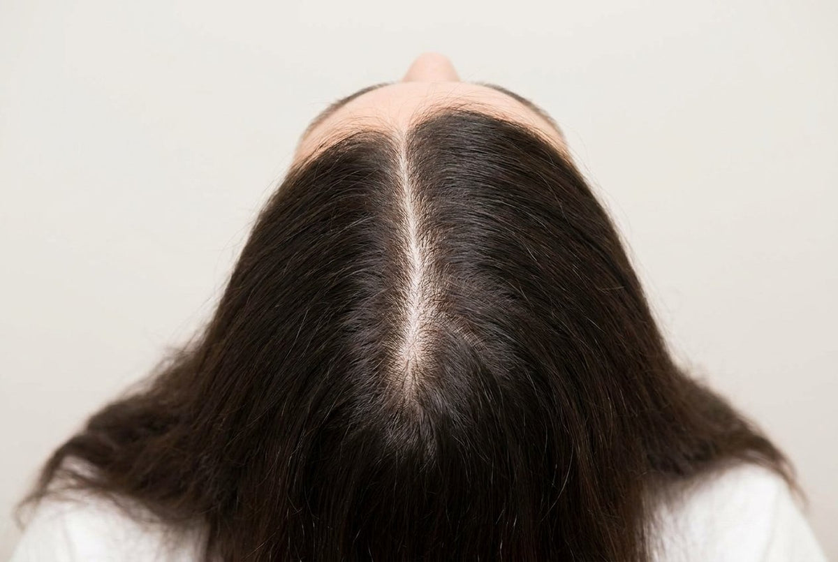 Part Line Density — Women — before