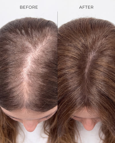Advanced Women’s Hair Growth & Density Set