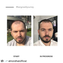 Hair Growth Serum – Botanical Peptide Complex